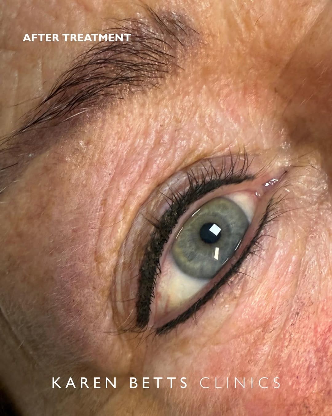 Post 6 by Karen Betts | Permanent Makeup on Instagram (image)