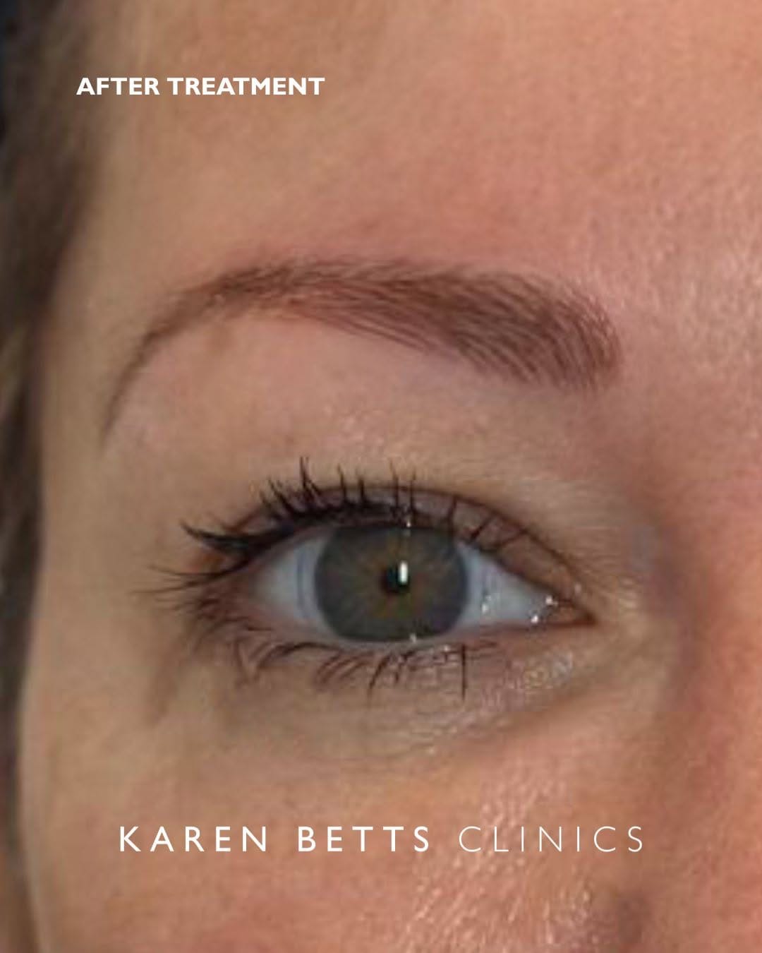 Post 3 by Karen Betts | Permanent Makeup on Instagram (carousel)
