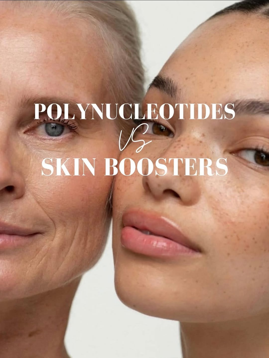 Post 3 by Aesthetics Experts - London, Herts & Oxon on Instagram (carousel)