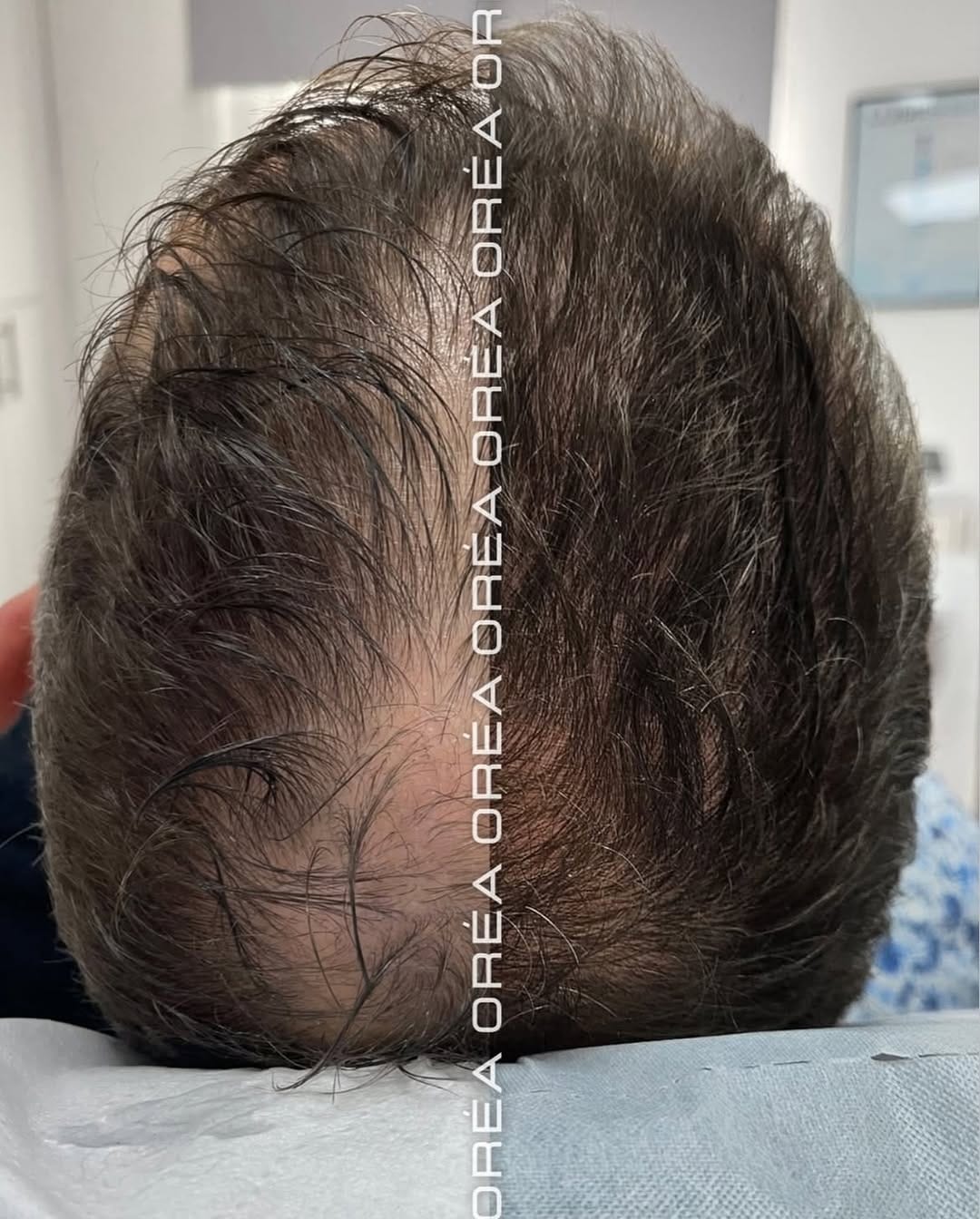 Post 8 by Aesthetics Experts - London, Herts & Oxon on Instagram (image)