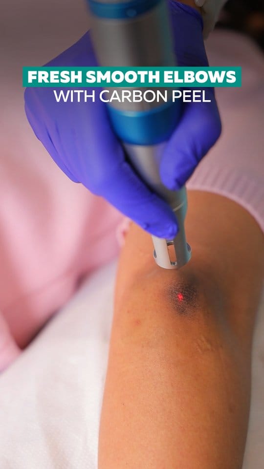 Post 4 by Halcyon Medispa & Wellness Clinic ™ on Instagram (video)