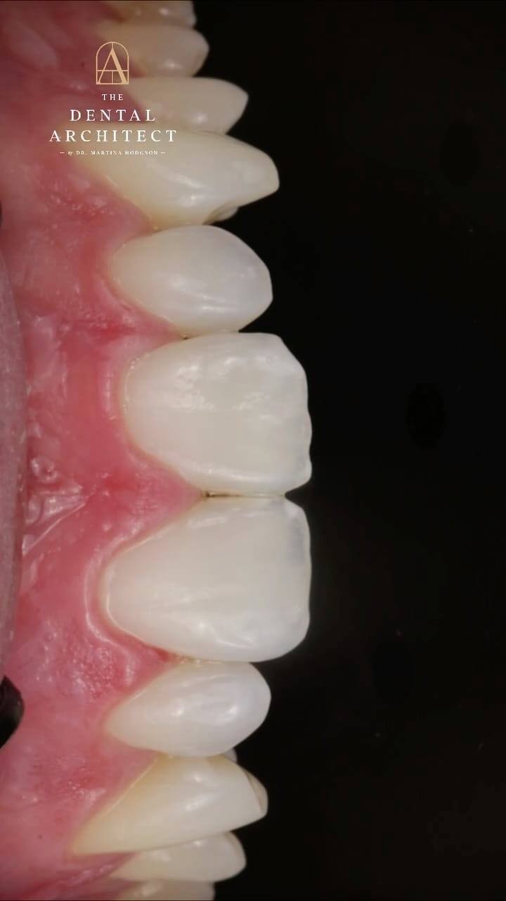 Post 8 by Dr Martina Hodgson BChD MJDF PGDip on Instagram (video)