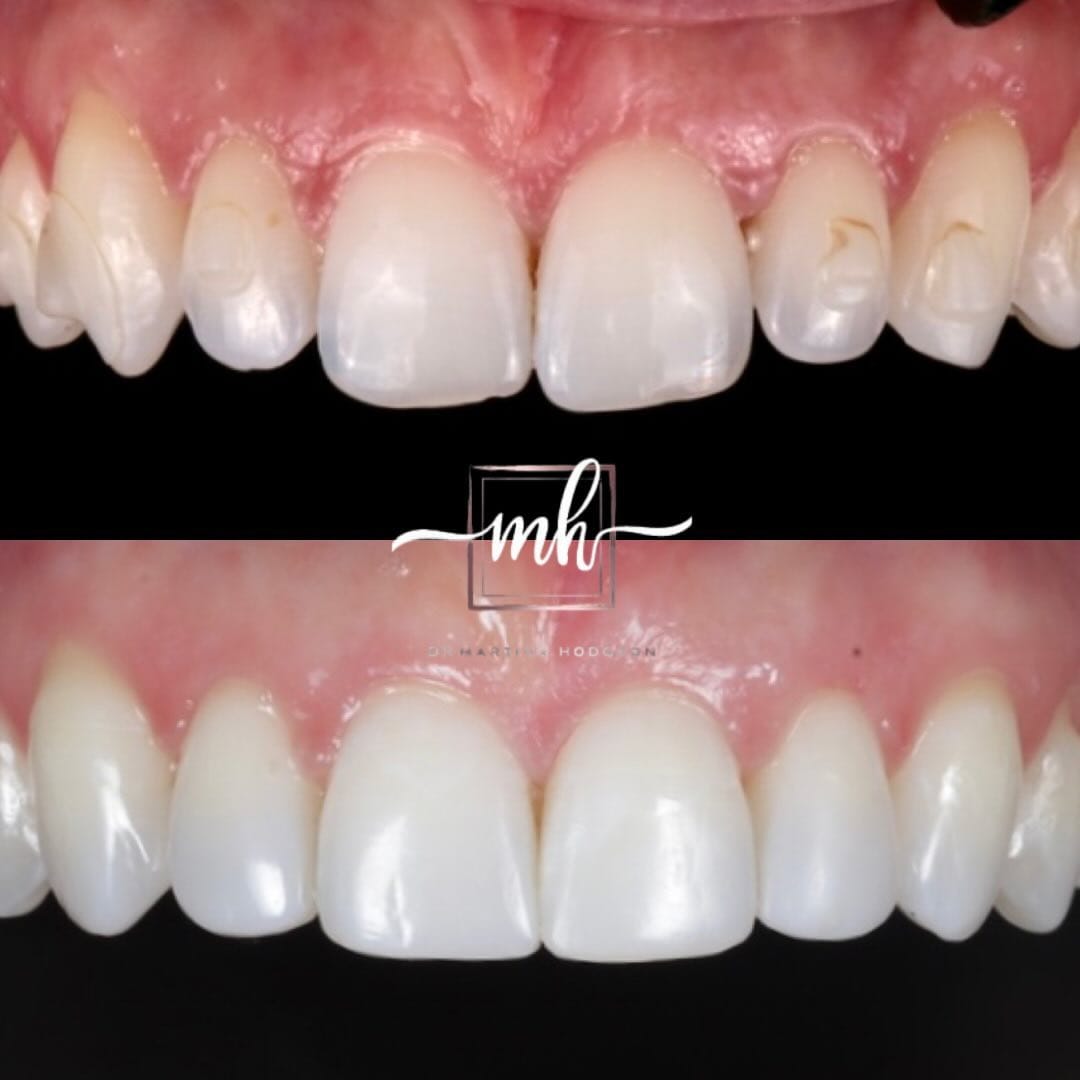 Post 10 by Dr Martina Hodgson BChD MJDF PGDip on Instagram (carousel)