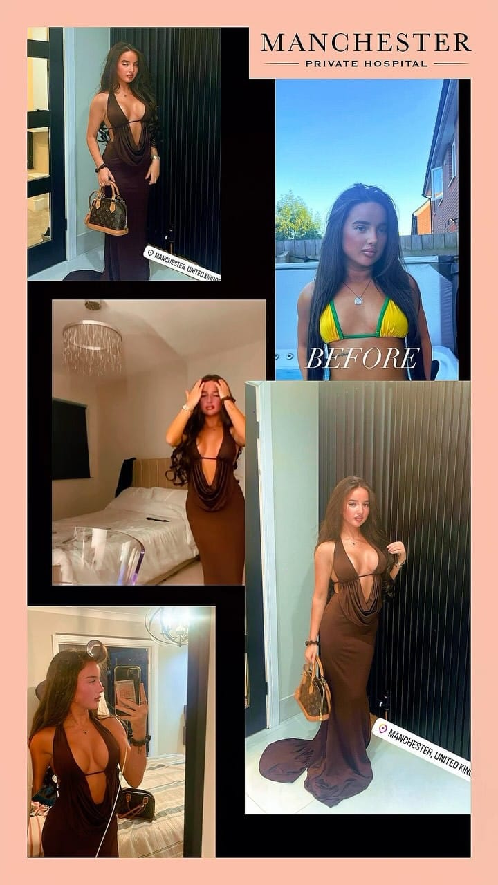 Post 8 by Manchester Private Hospital on Instagram (video)