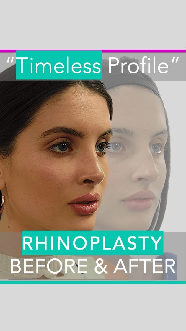 Post 10 by Berkeley Square Medical on Instagram (video)