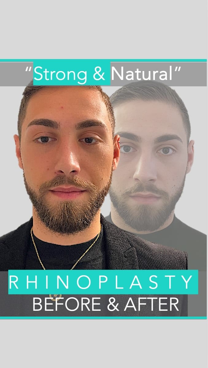 Post 8 by Berkeley Square Medical on Instagram (video)