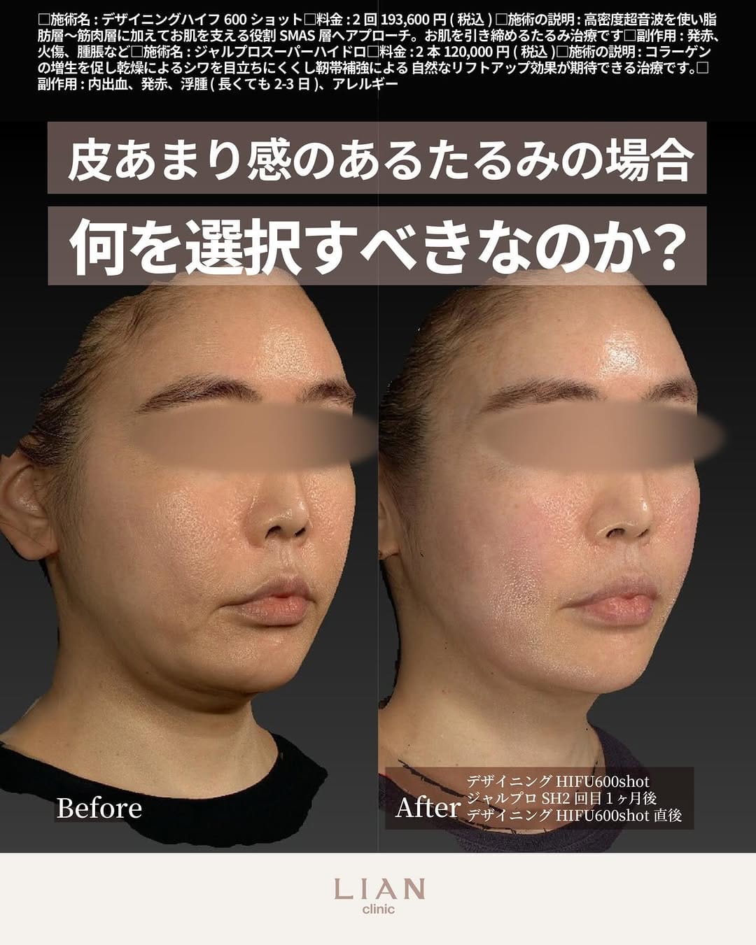 Post 3 by 藤尾有紀/yuki fujio/ゆきまろ看護師 on Instagram (carousel)