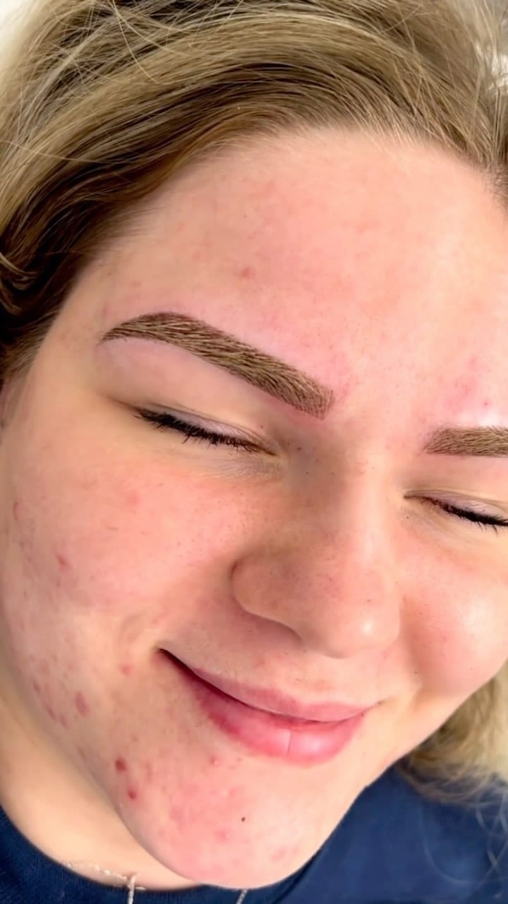 Post 8 by Dr Eyebrows on Instagram (video)