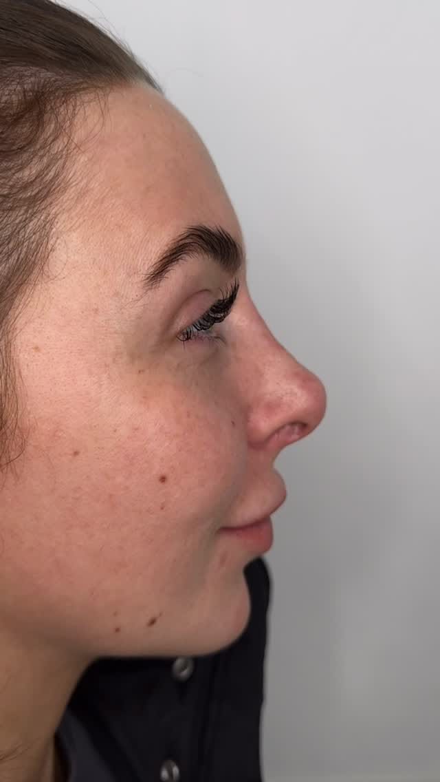 Post 3 by SOPHIE ANN AESTHETICS on Instagram (video)