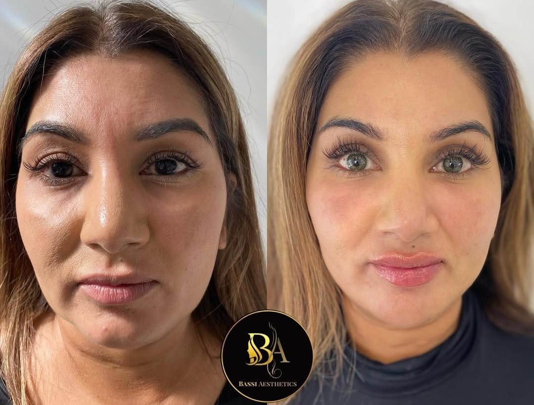 Post 10 by Babita Bassi 🧿 on Instagram (image)