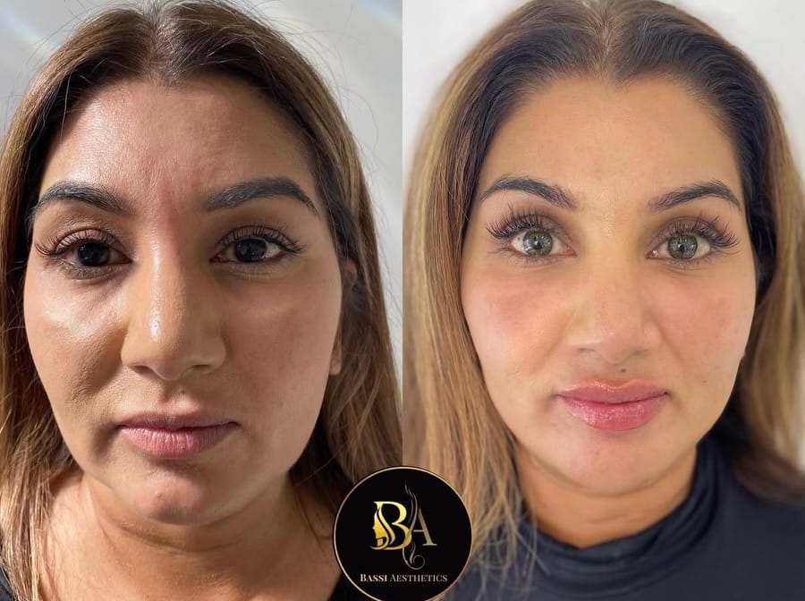 Post 7 by Babita Bassi 🧿 on Instagram (carousel)