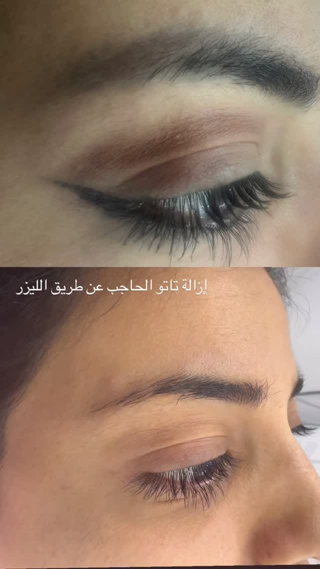 Post 2 by Amal skin care on Instagram (video)