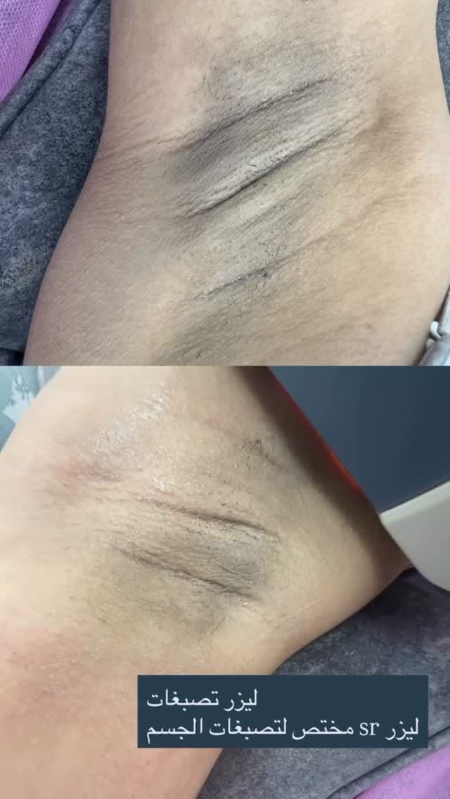 Post 1 by Amal skin care on Instagram (video)
