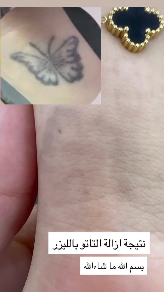 Post 3 by Amal skin care on Instagram (video)