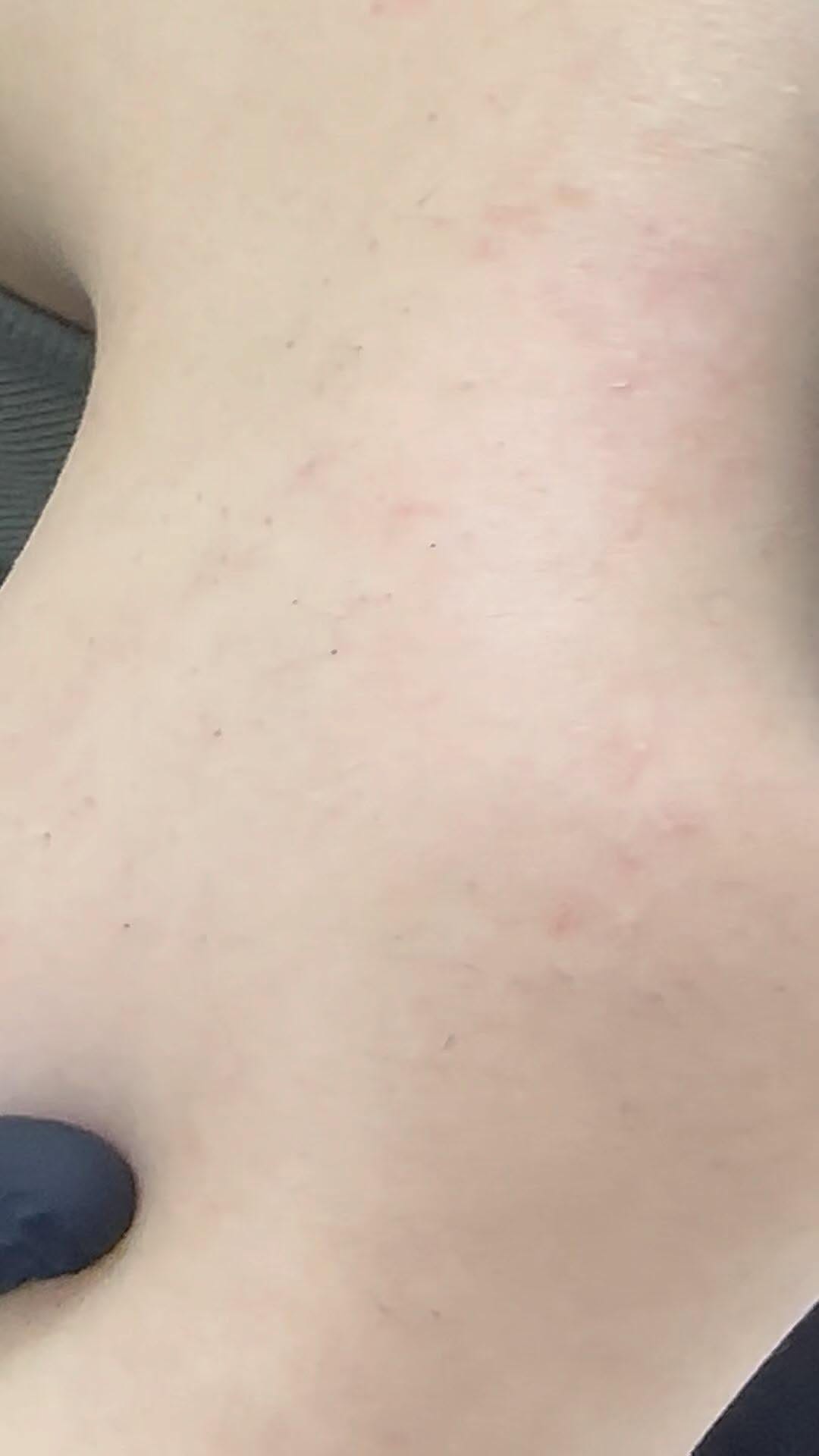 Post 8 by Amal skin care on Instagram (video)