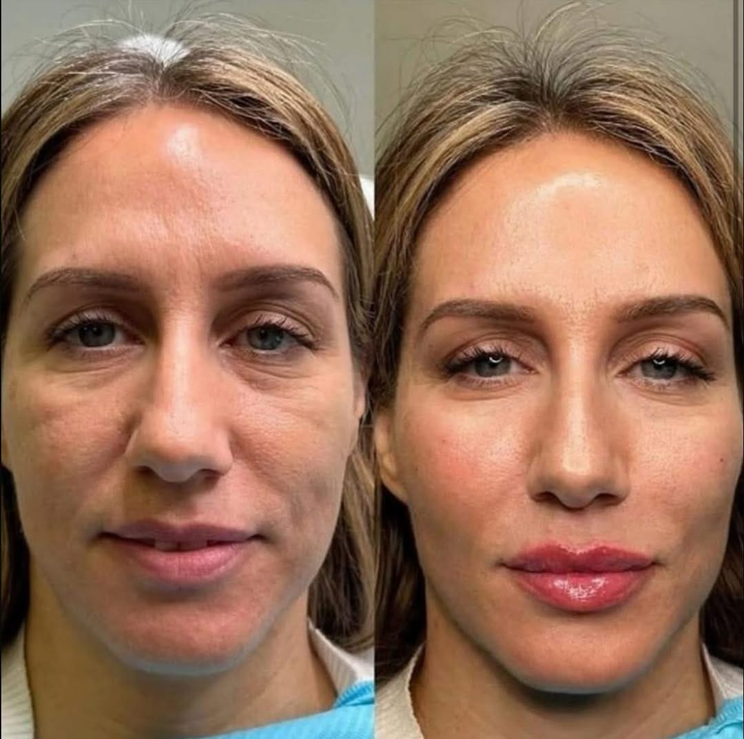 Post 5 by Aesthetics & SPMU Clinics | Beauty & Aesthetics Academy on Instagram (carousel)