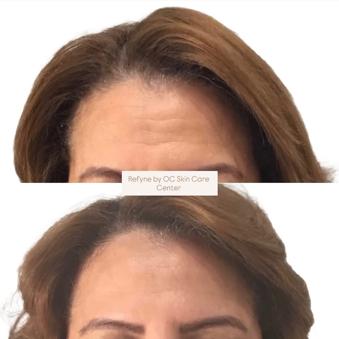 Post 3 by OC Skin Care Center on Instagram (carousel)