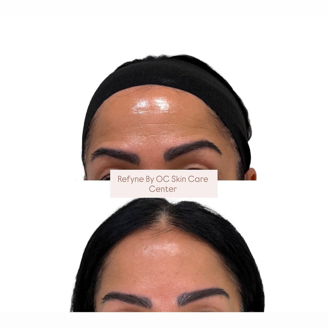 Post 4 by OC Skin Care Center on Instagram (image)