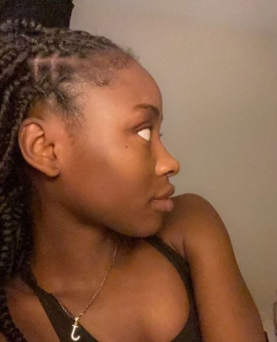 Post 10 by Ashanti Aesthetic Beauty Treatment Rooms London on Instagram (image)