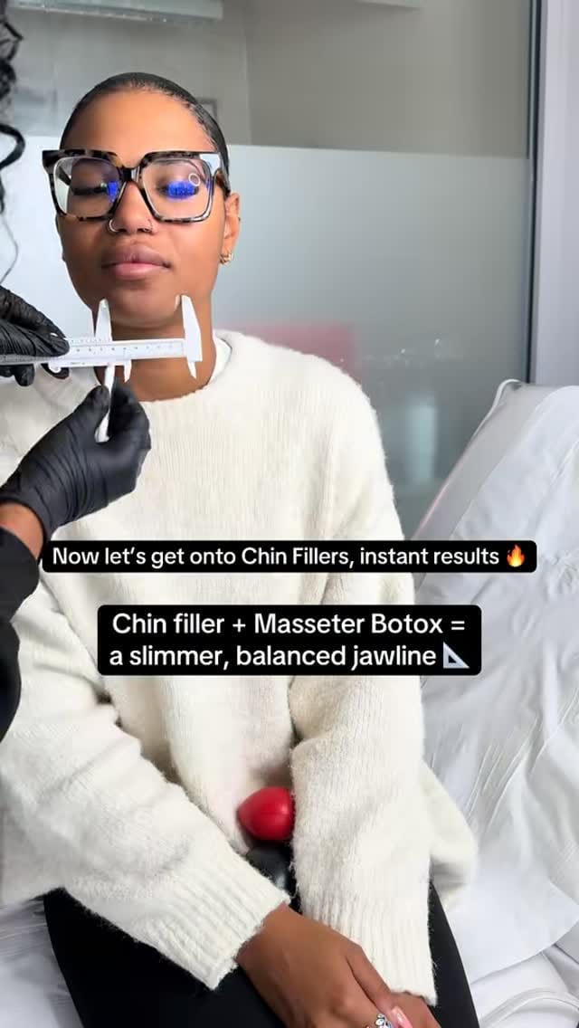 Post 9 by Aesthetics & Training 💉 on Instagram (video)