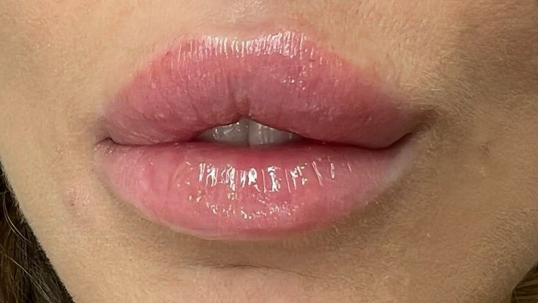 Post 9 by Alexandra Watkinson on Instagram (image)