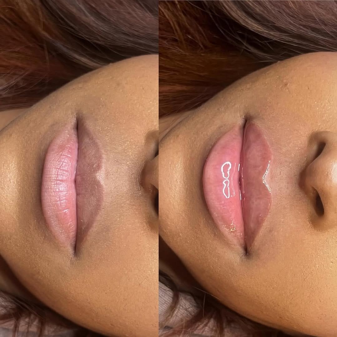 Post 7 by HM COSMETICS | CELEBRITY BEAUTY & AESTHETICS on Instagram (carousel)