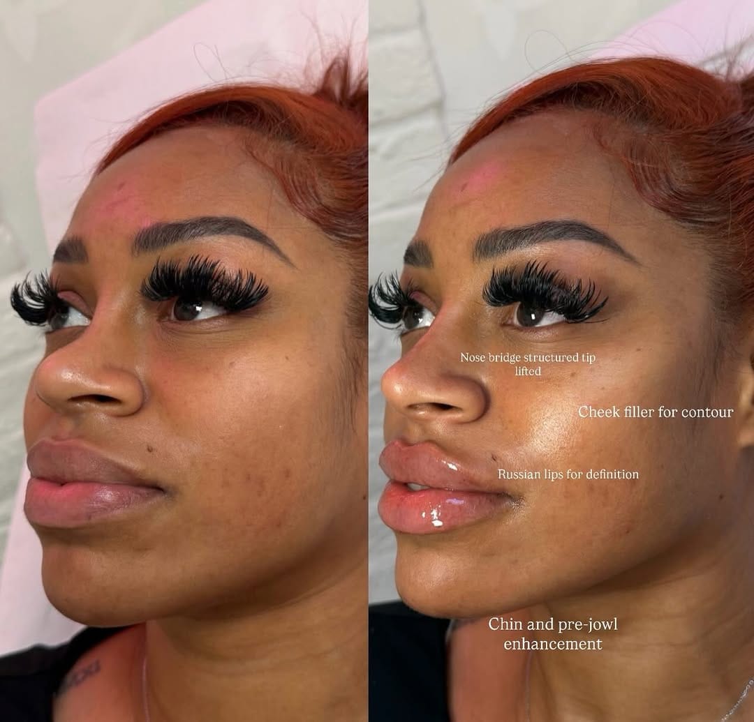 Post 5 by HM COSMETICS | CELEBRITY BEAUTY & AESTHETICS on Instagram (carousel)