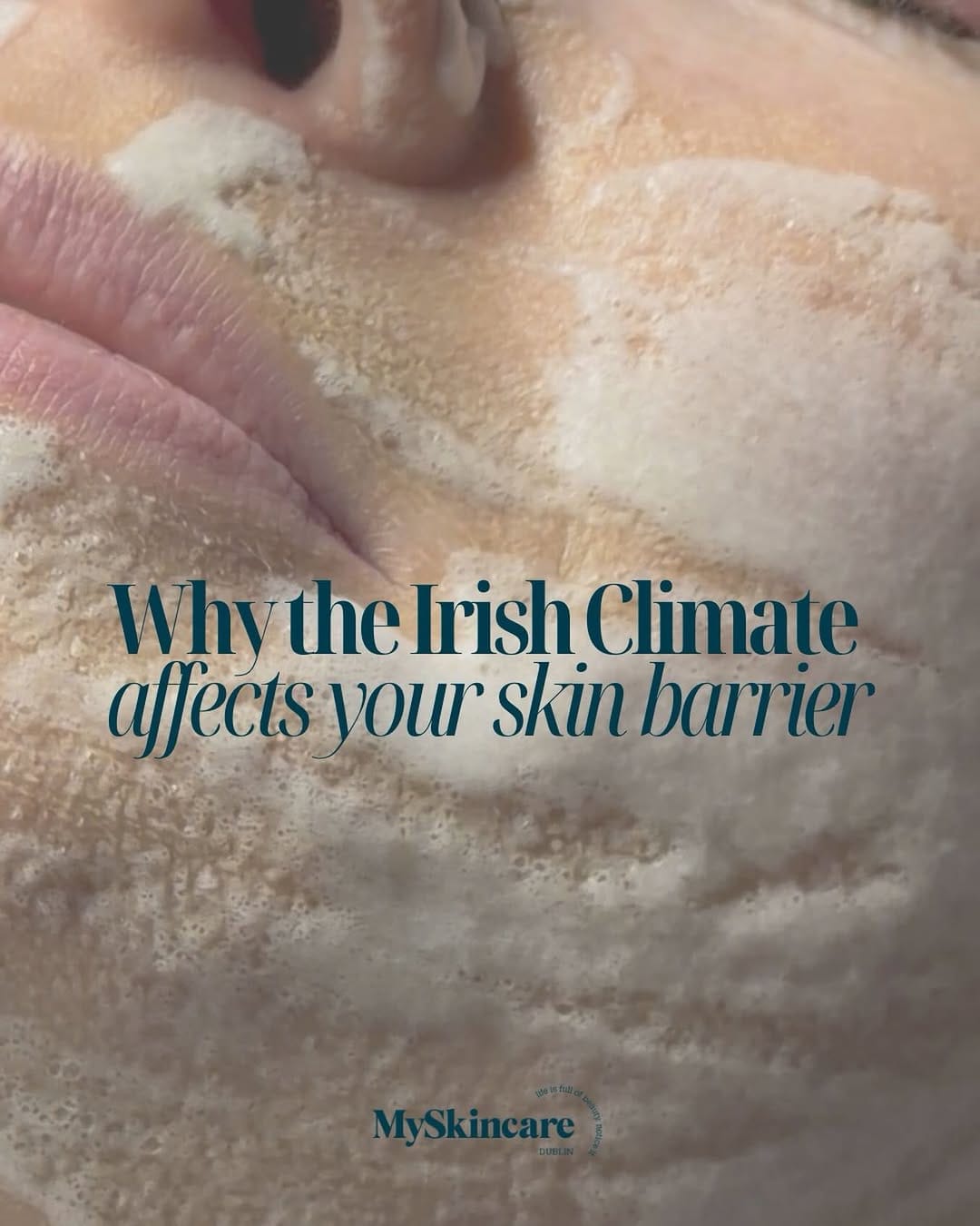 Post 3 by Myskincare.ie on Instagram (image)