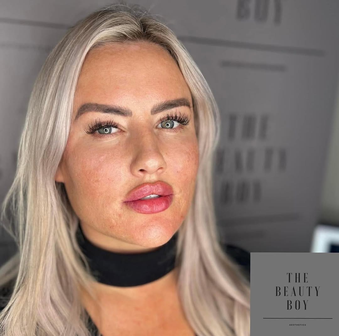 Post 9 by The Beauty Boy Aesthetics on Instagram (image)