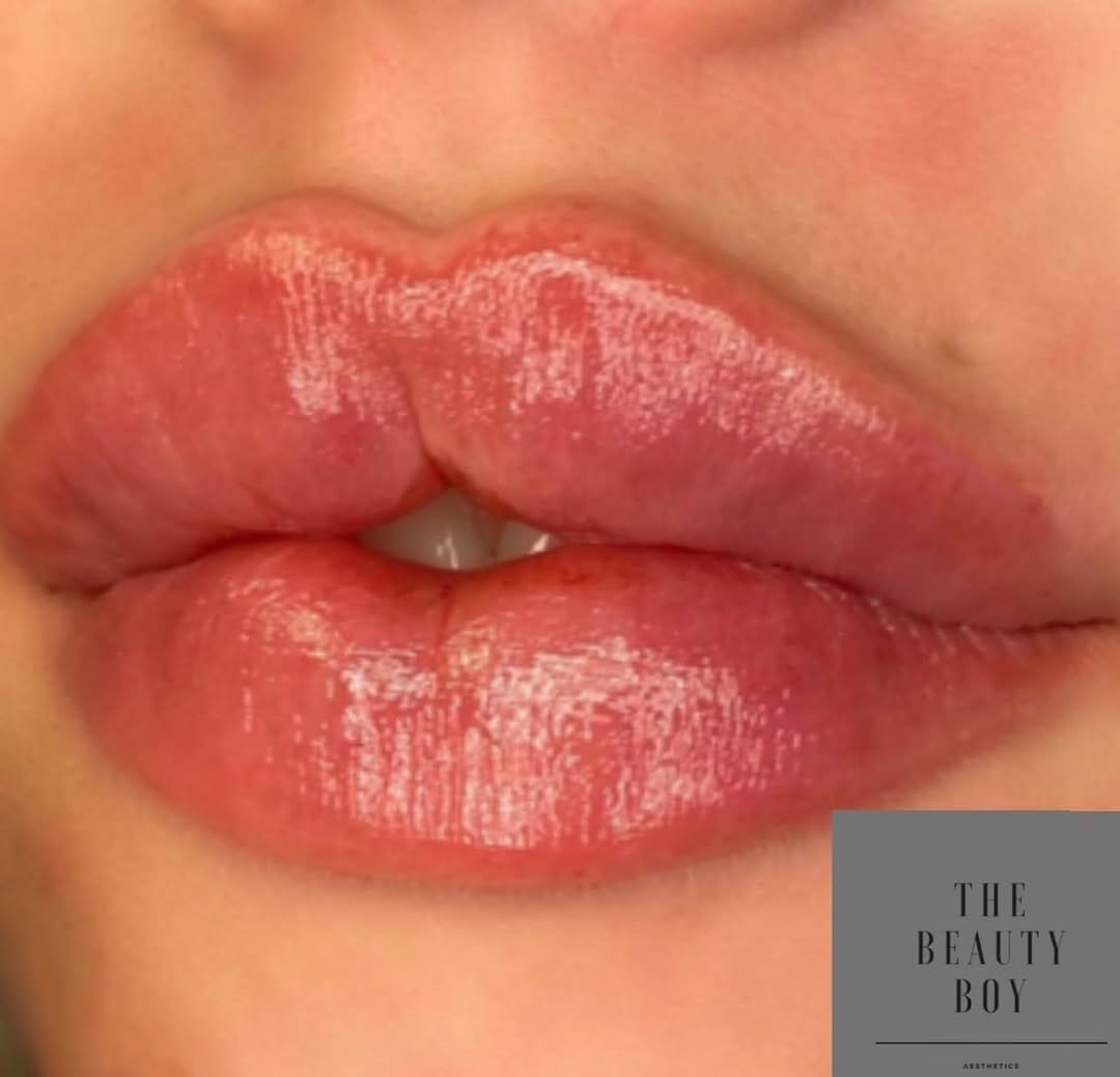 Post 10 by The Beauty Boy Aesthetics on Instagram (image)