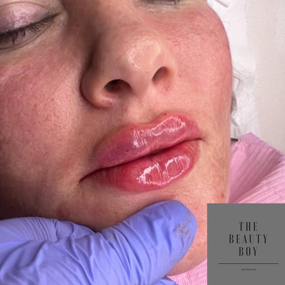 Post 8 by The Beauty Boy Aesthetics on Instagram (image)