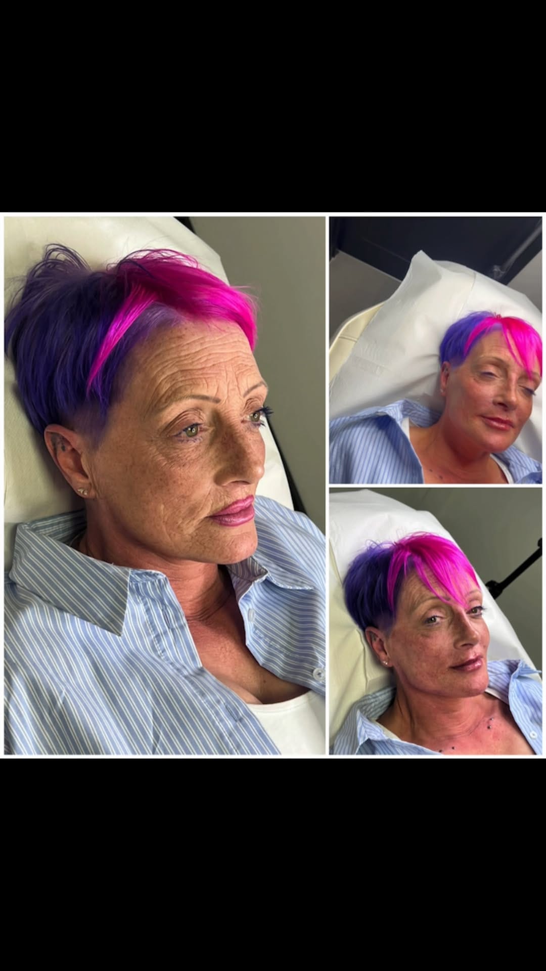 Post 2 by The Beauty Boy Aesthetics on Instagram (video)