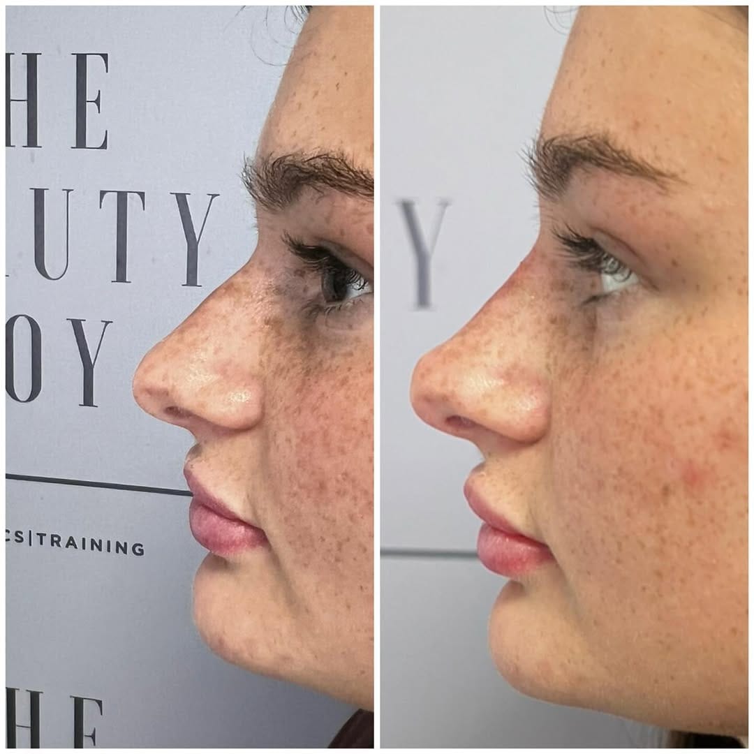 Post 4 by The Beauty Boy Aesthetics on Instagram (image)