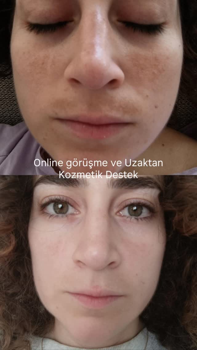 Post 4 by Uzman Eczacı Hatice Deniz on Instagram (video)