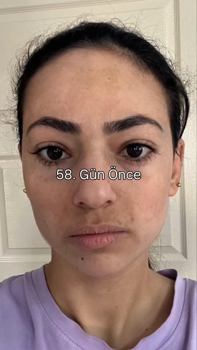 Post 2 by Uzman Eczacı Hatice Deniz on Instagram (video)