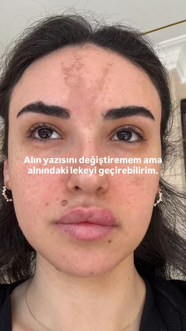 Post 3 by Uzman Eczacı Hatice Deniz on Instagram (video)