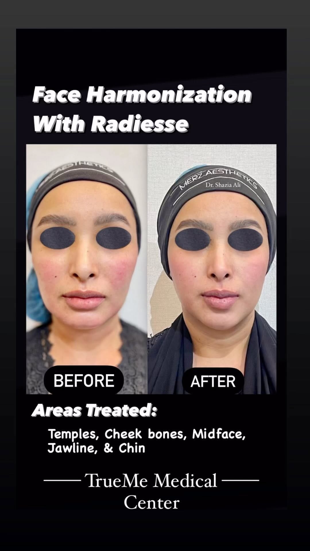 Post 9 by Shazia A Ali on Instagram (video)