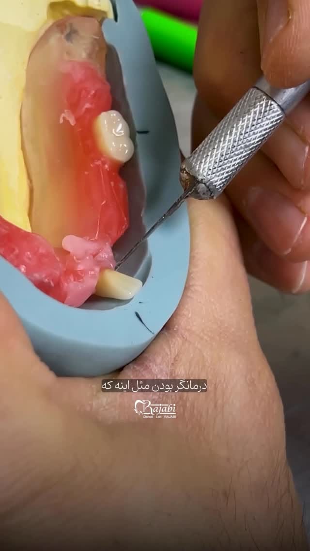 Post 1 by لابراتوار دندانسازی احسان اله رجبی/قزوین on Instagram (video)