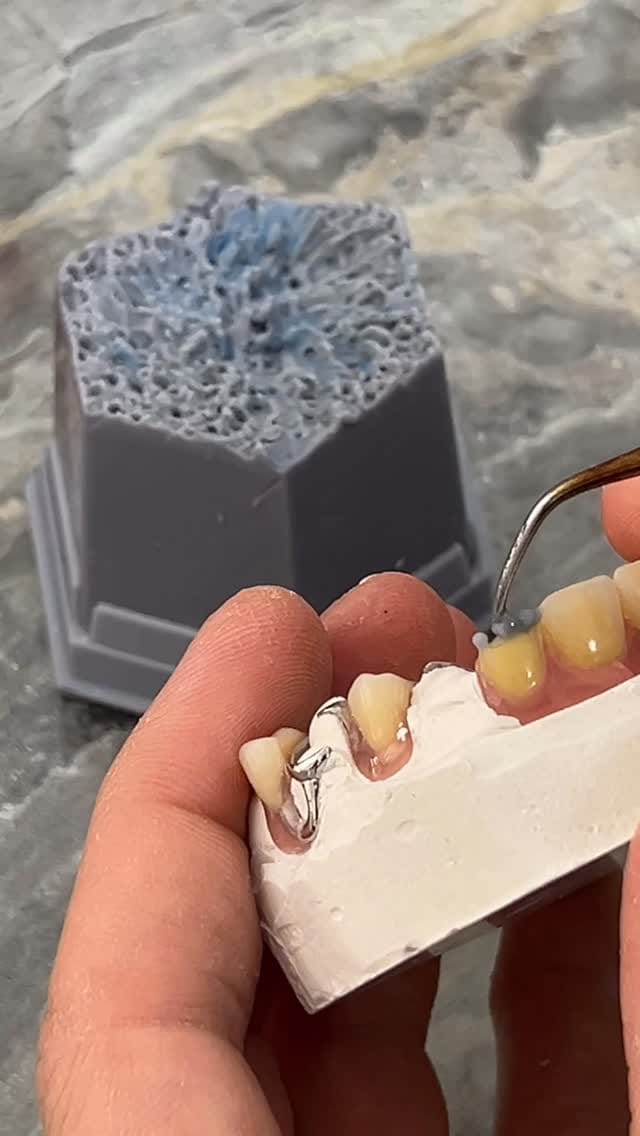 Post 2 by لابراتوار دندانسازی احسان اله رجبی/قزوین on Instagram (video)