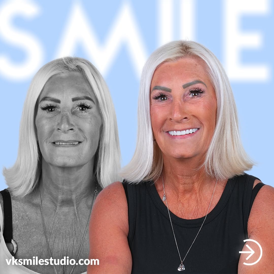 Post 7 by Vk Smile Studio on Instagram (carousel)