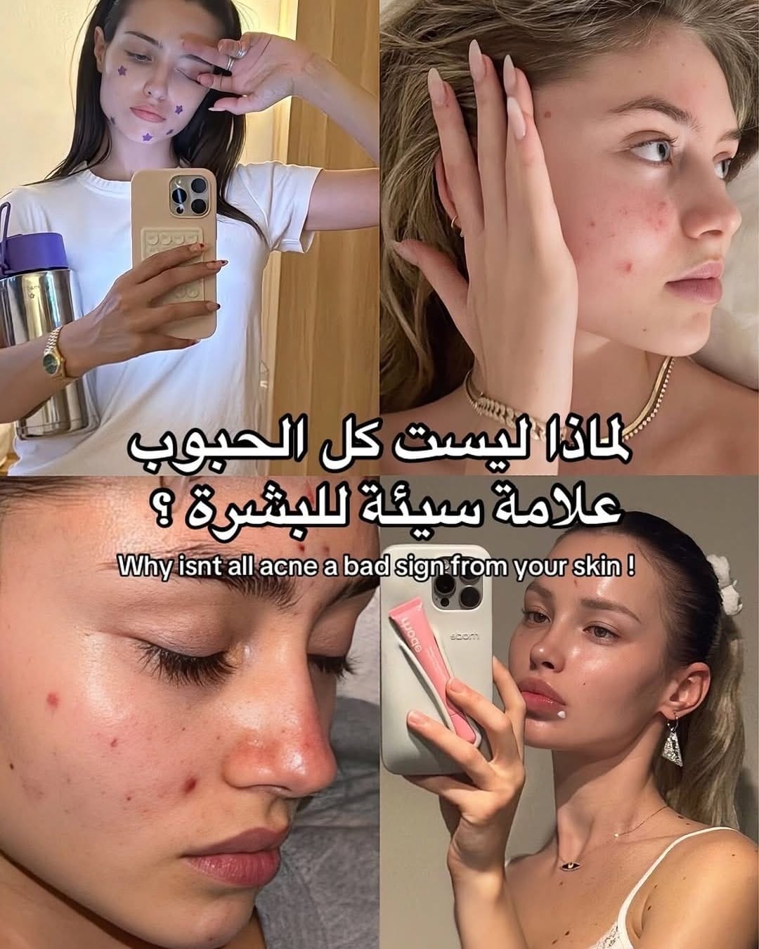 Post 5 by SkinCare Notice on Instagram (carousel)