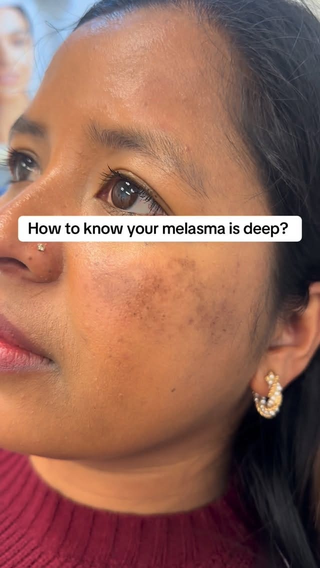 Post 6 by Skincare Nepal on Instagram (video)