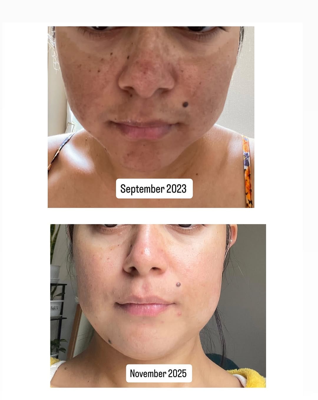 Post 8 by Skincare Nepal on Instagram (image)
