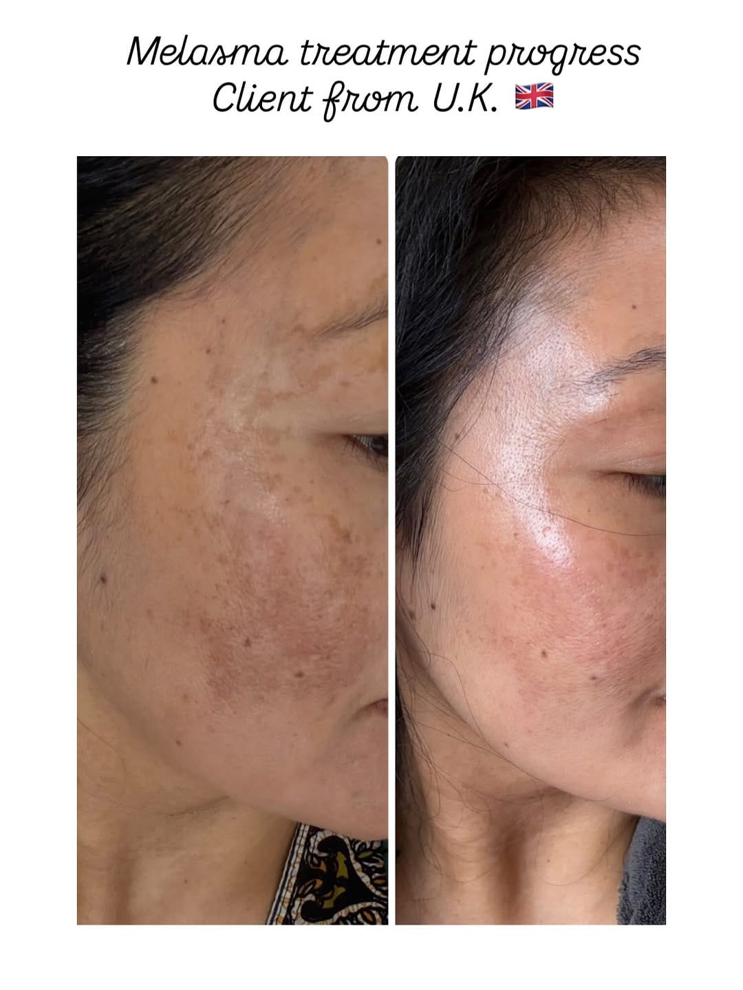 Post 1 by Skincare Nepal on Instagram (carousel)