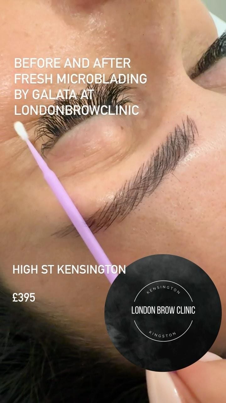 Post 10 by LONDON BROW CLINIC on Instagram (video)