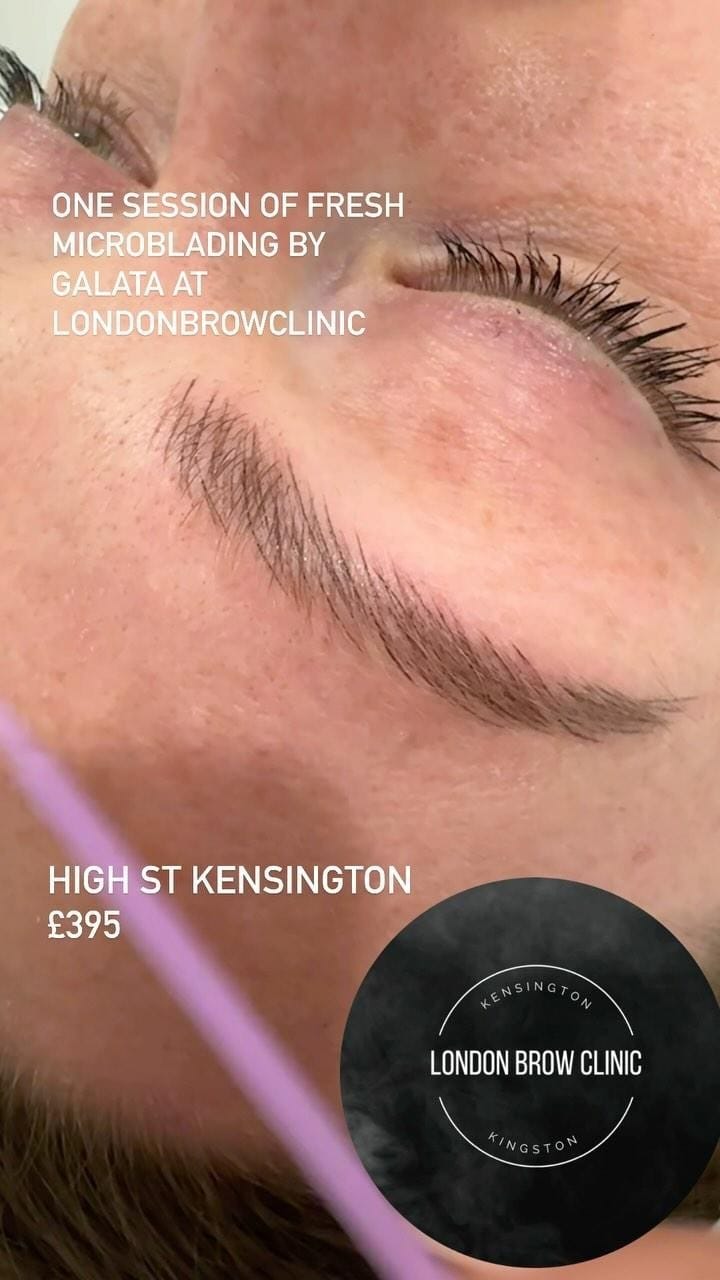 Post 8 by LONDON BROW CLINIC on Instagram (video)