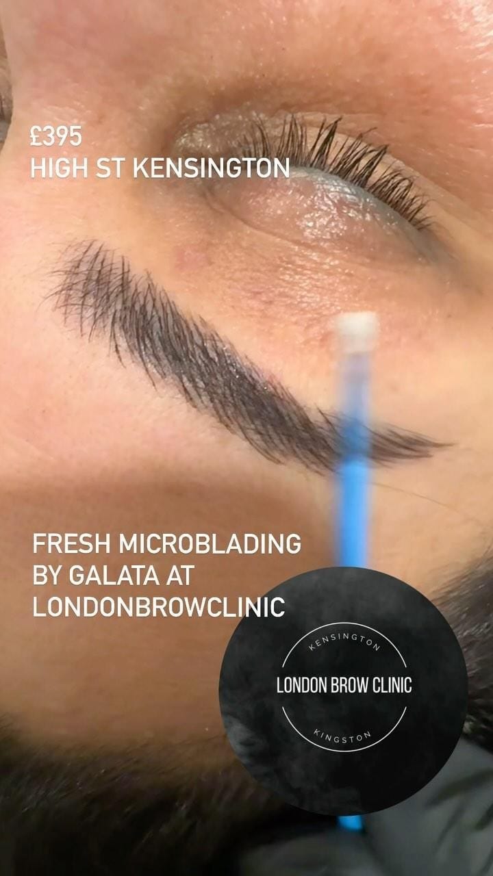 Post 9 by LONDON BROW CLINIC on Instagram (video)