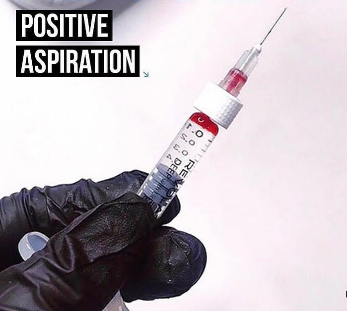 Post 10 by SK:N VANITY AESTHETICS SURREY💉 on Instagram (image)