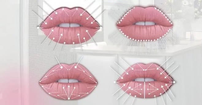 Post 8 by SK:N VANITY AESTHETICS SURREY💉 on Instagram (image)