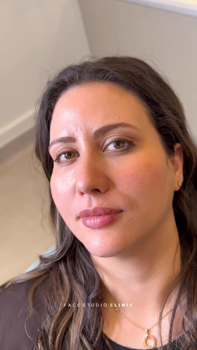 Post 10 by Face Studio Clinic | Skin, Dental & Aesthetics on Instagram (video)